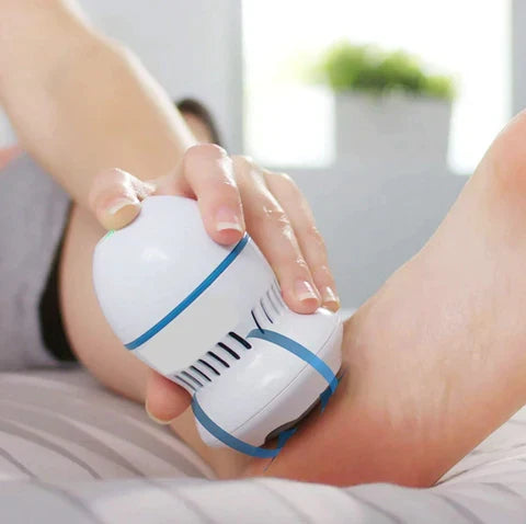 BODY & BLOOM Vacuum Callus Remover